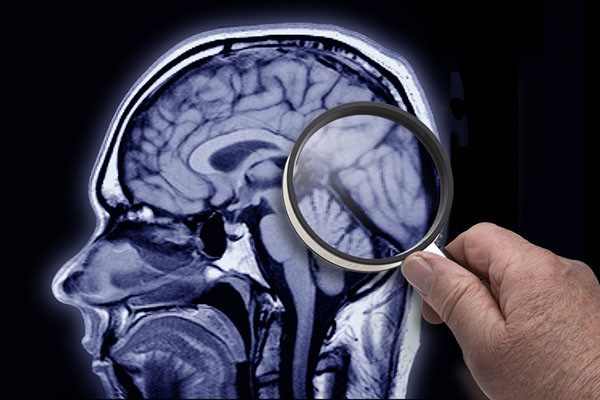 photo of an MRI scan of a person's brain with a hand holding a magnifying glass over a portion of it